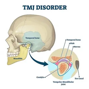 What is the TMJ and how can we treat it?